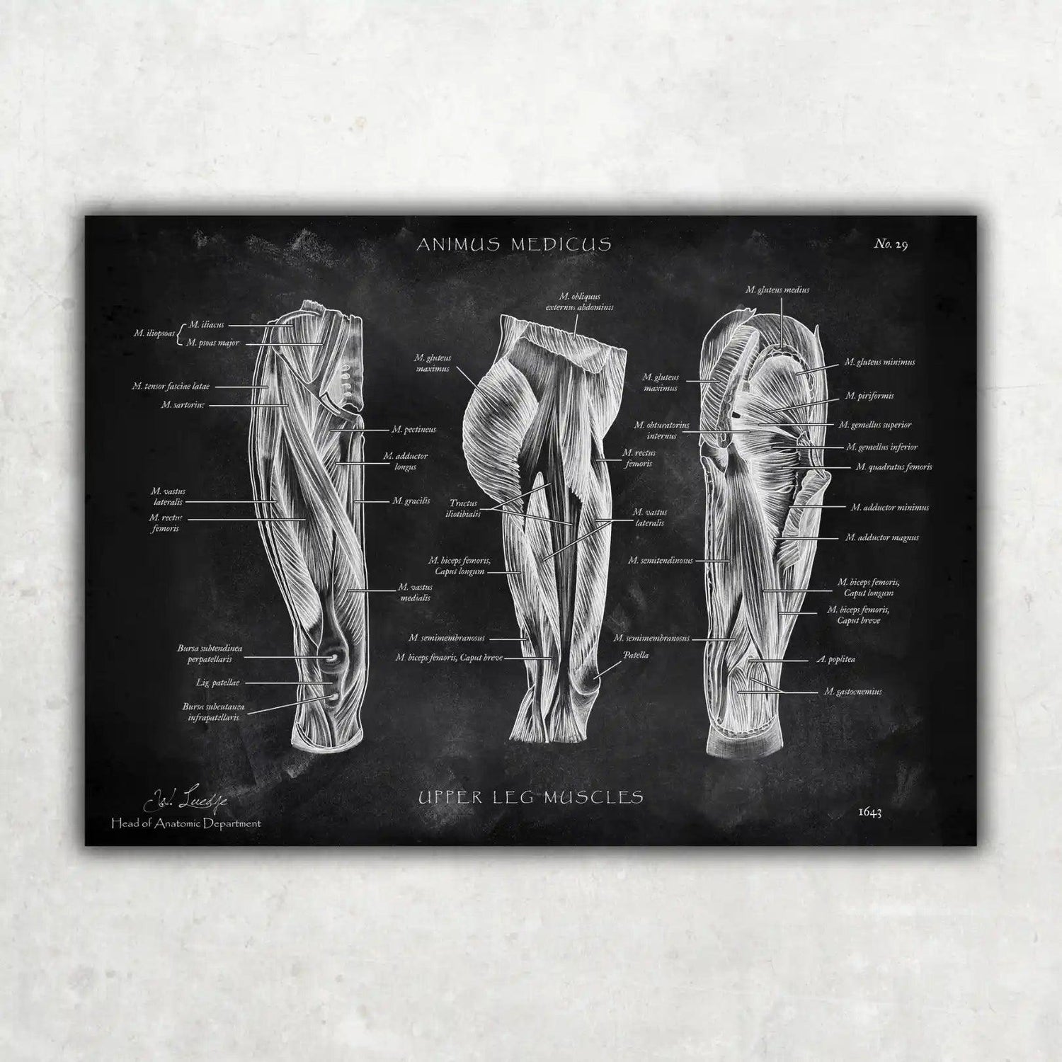 Oberschenkel Muskeln - Chalkboard - Animus Medicus GmbH