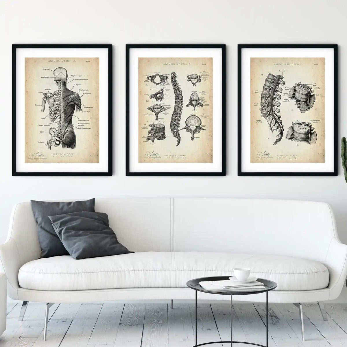 Rücken Anatomie Sammlung - Animus Medicus GmbH