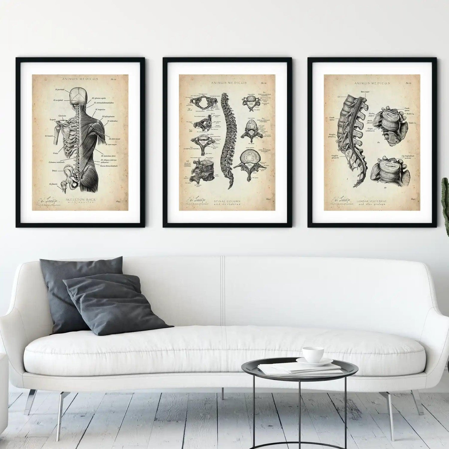 Rücken Anatomie Sammlung - Animus Medicus GmbH