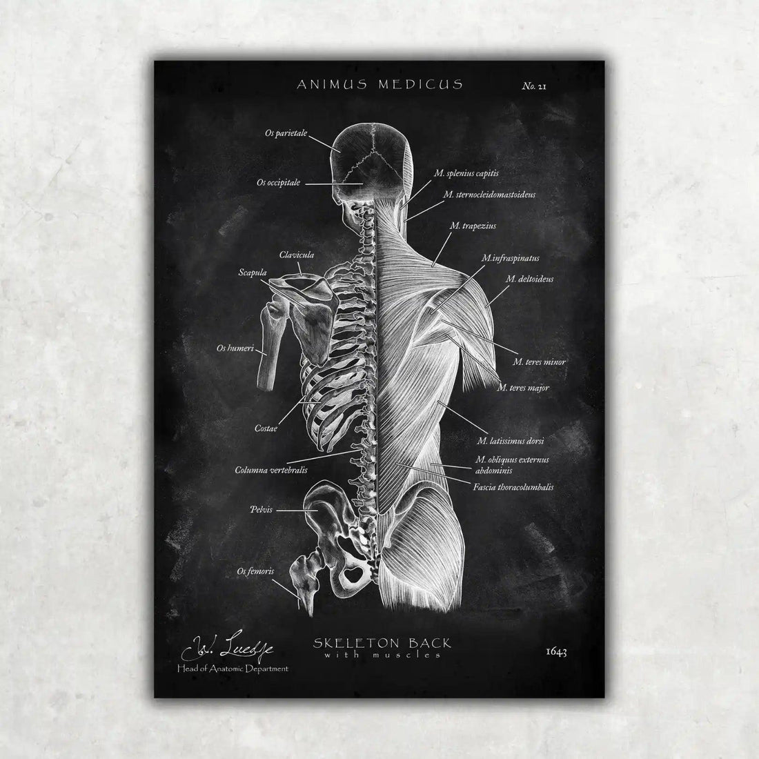 Rücken Anatomie Sammlung - Chalkboard - Animus Medicus GmbH