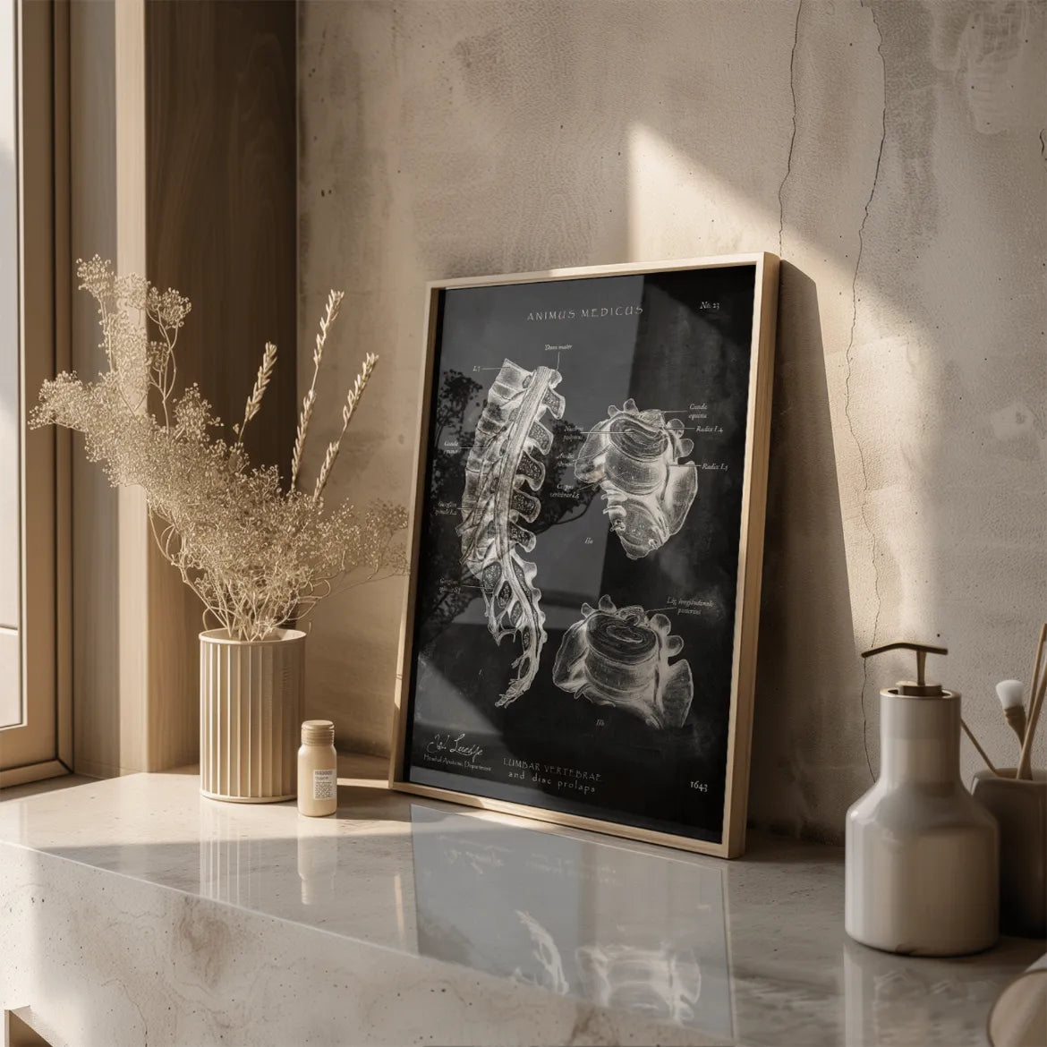 Rücken Anatomie Sammlung - Chalkboard - Animus Medicus GmbH