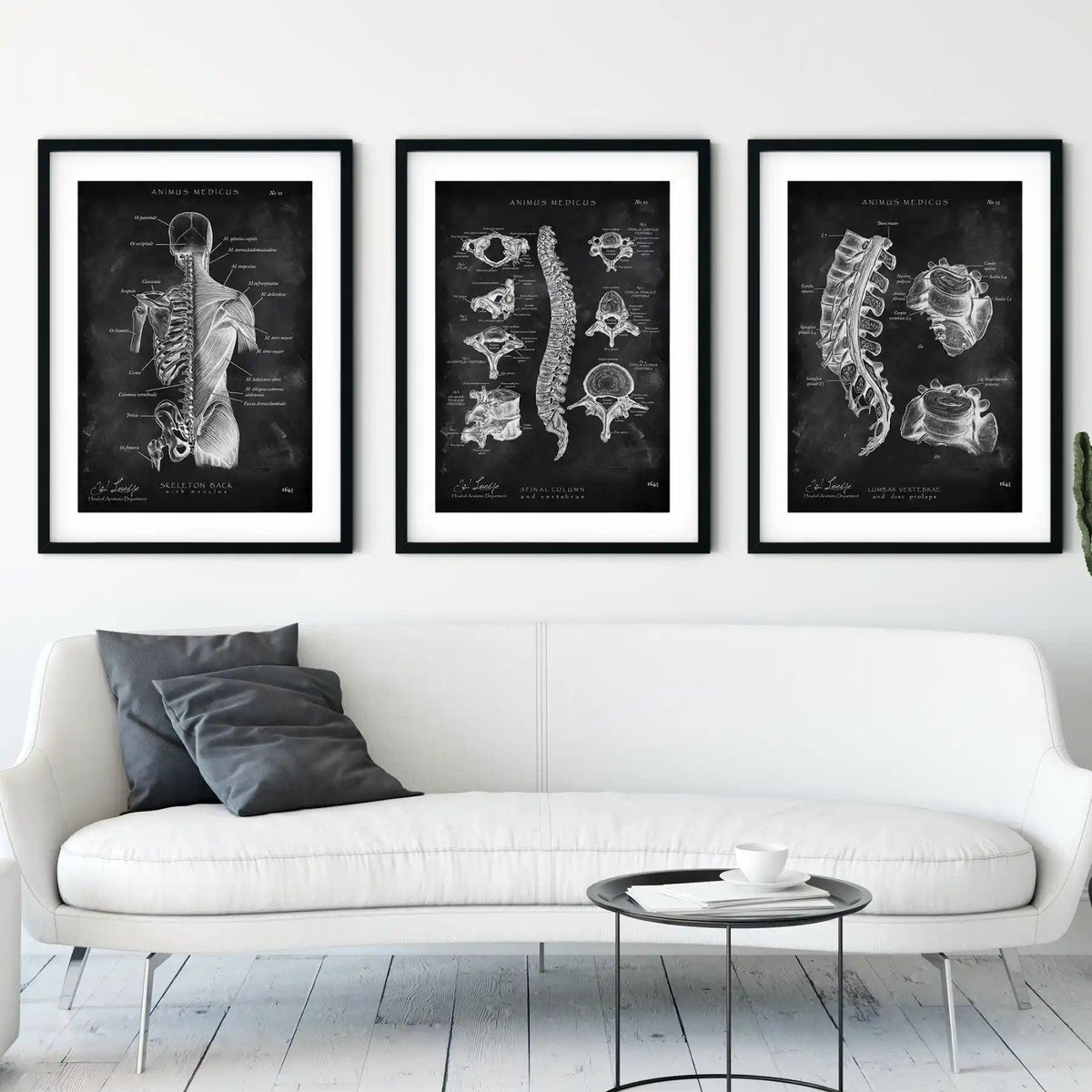 Rücken Anatomie Sammlung - Chalkboard - Animus Medicus GmbH
