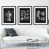Rücken Anatomie Sammlung - Chalkboard - Animus Medicus GmbH