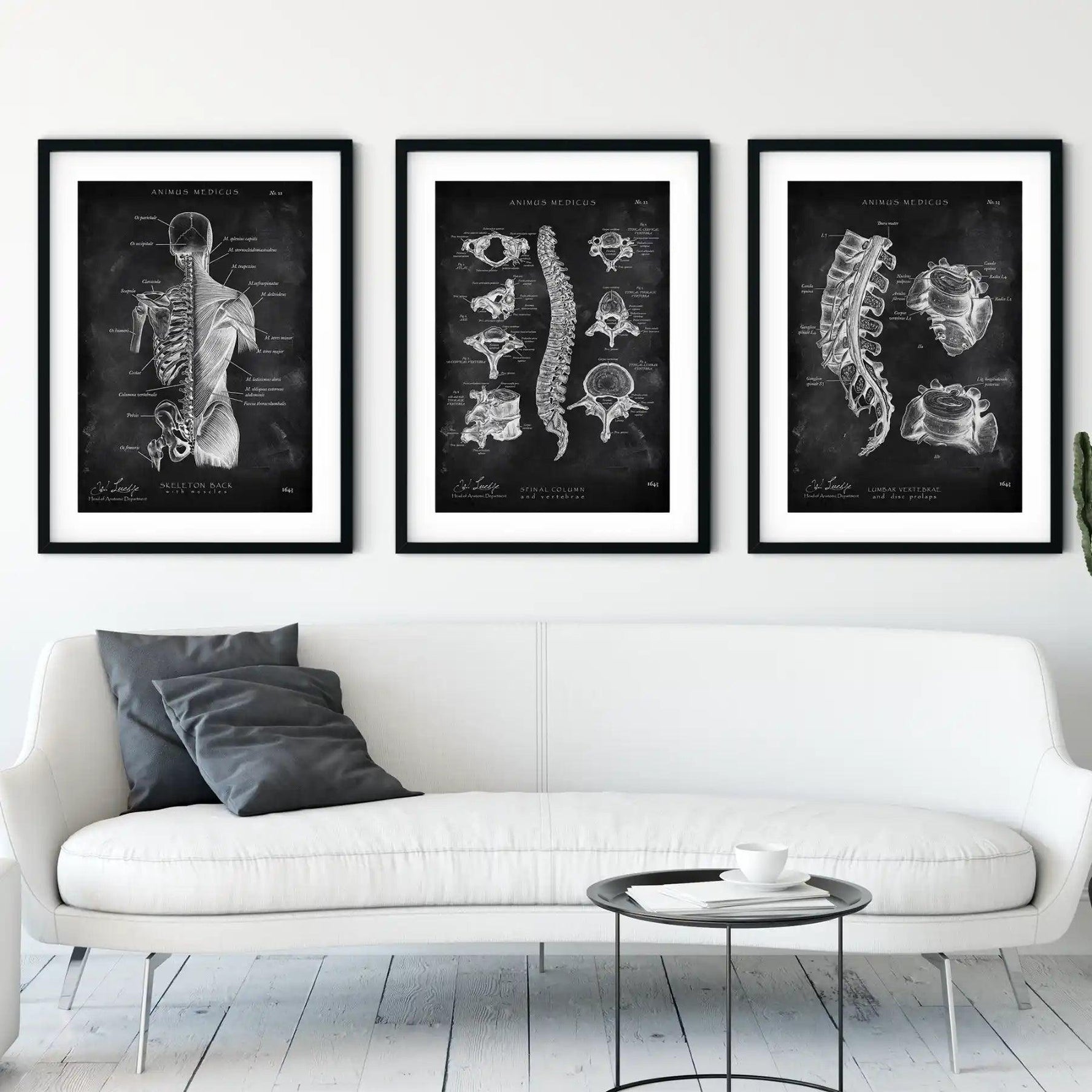 Rücken Anatomie Sammlung - Chalkboard - Animus Medicus GmbH