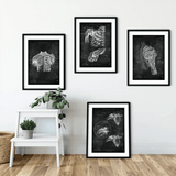 Schulter Anatomie Sammlung - Chalkboard - Animus Medicus GmbH