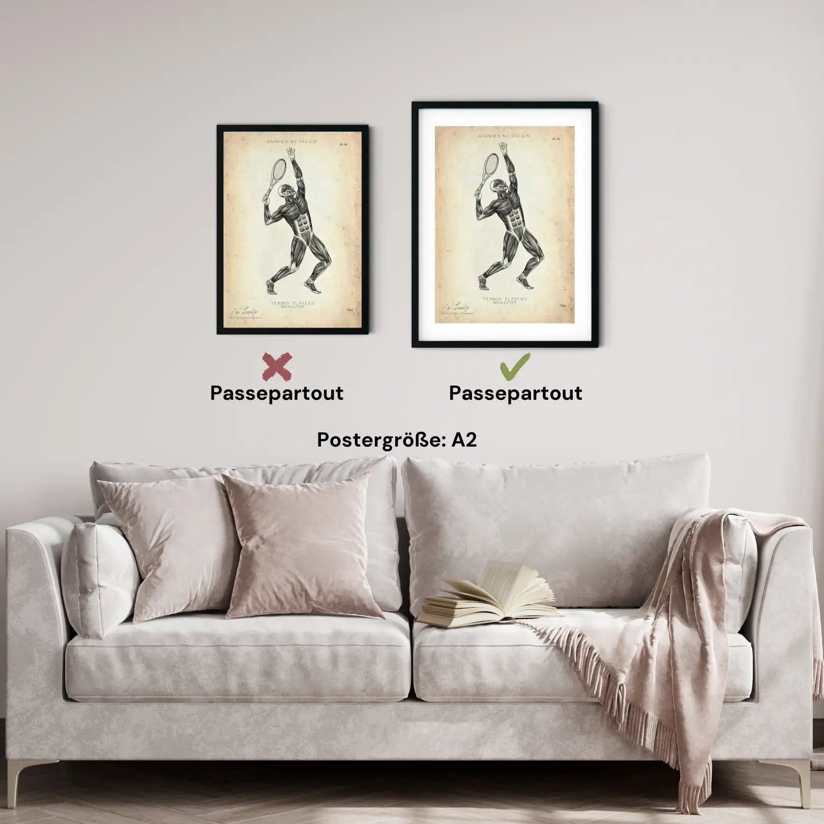 Tennis Anatomie Poster - Animus Medicus GmbH