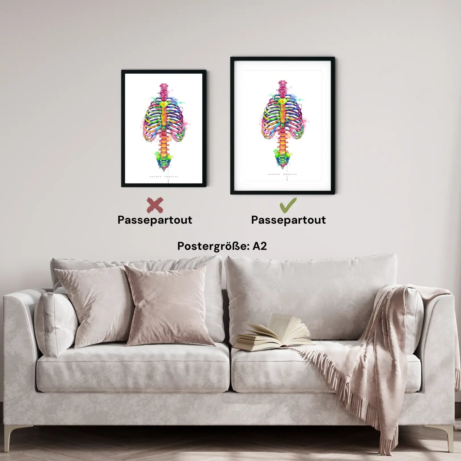 Thorax Anatomie - Rainbow - Animus Medicus GmbH