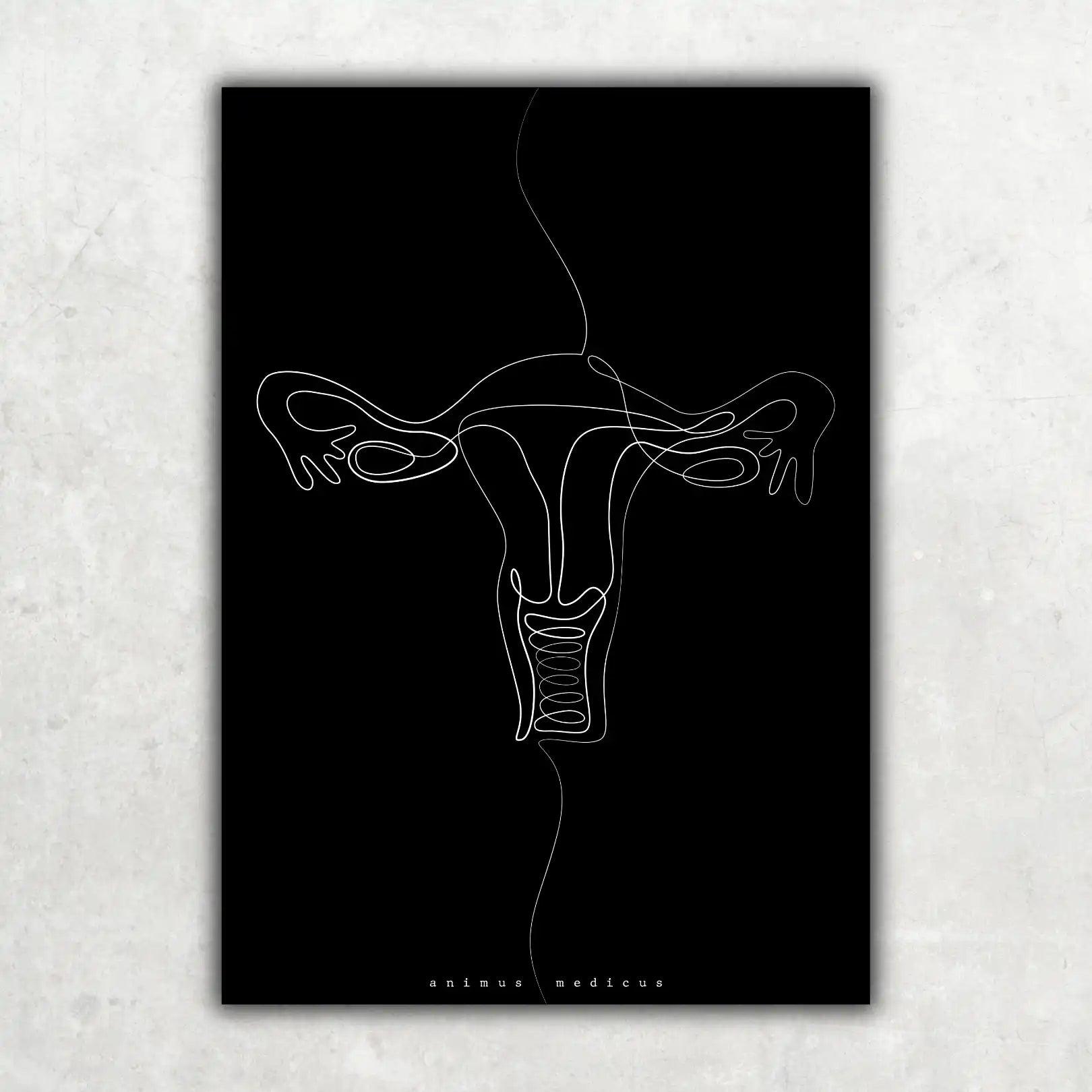Uterus Anatomie Minimalist Dark - Animus Medicus GmbH