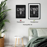 Uterus mit Adnexe - Chalkboard - Animus Medicus GmbH