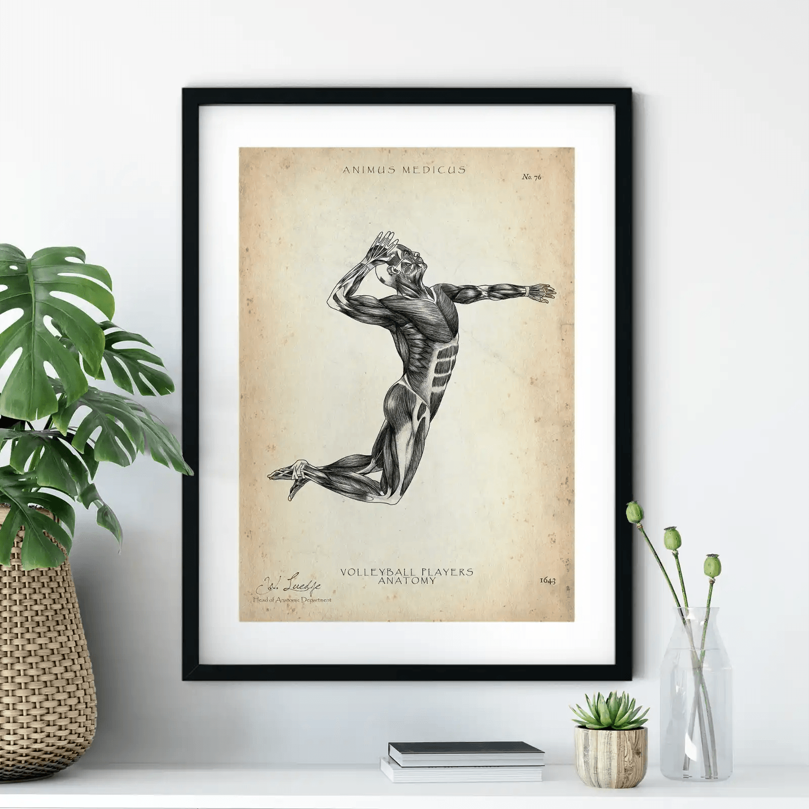 Volleyball Anatomie Poster - Animus Medicus GmbH
