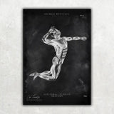 Volleyball Anatomie Poster - Chalkboard - Animus Medicus GmbH