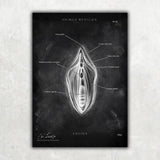Vulva Anatomie Poster - Chalkboard - Animus Medicus GmbH