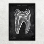 Zahn Anatomie im Querschnitt - Chalkboard - Animus Medicus GmbH